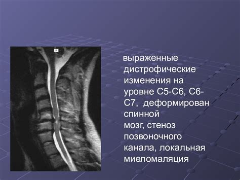 Причины развития дистрофических изменений позвоночника