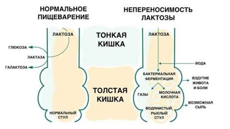 Причины развития непереносимости новокаина