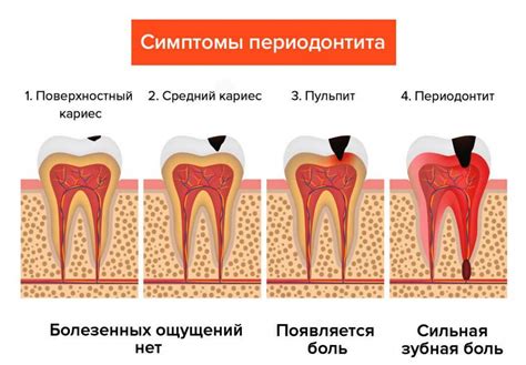 Причины развития хронического апикального периодонтита у женщин