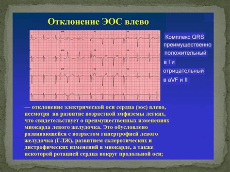 Причины расширения границ сердца влево