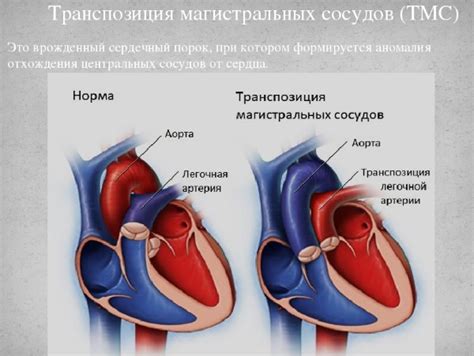 Причины расширения магистральных сосудов сердца