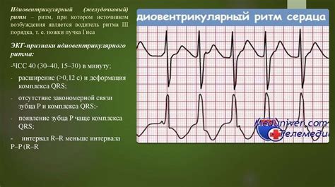 Причины синусовой брадикардии в вертикальном положении у взрослых