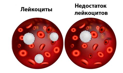 Причины снижения лейкоцитов