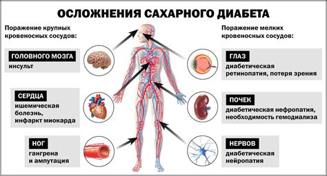 Причины тяжелого сахарного диабета