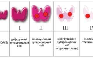 Причины увеличения щитовидной железы: основные факторы