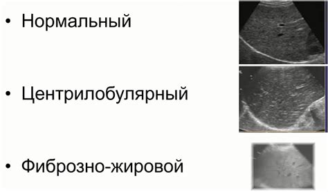 Причины умеренно диффузной неоднородности эхоструктуры печени