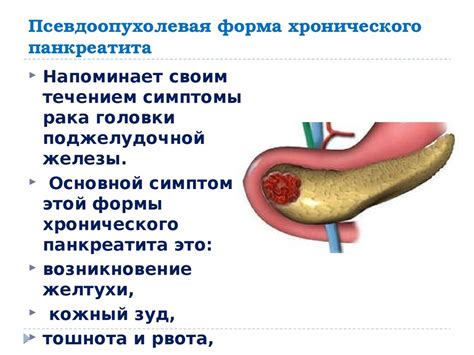 Причины хронического панкреатита