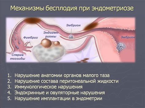 Причины эндометриоза у женщин