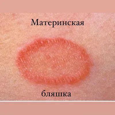 Проанализировать сны о высыпаниях и ранах на физиономии: мифы и реальность