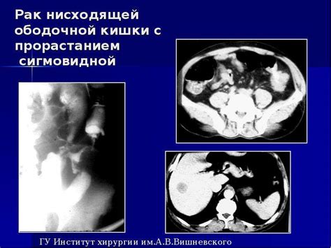 Проблемы желудочно-кишечного тракта вследствие чрезмерного потребления щелочи