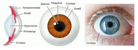 Проблемы со склерой глаза