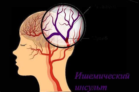 Проблемы с кровообращением и нервной системой