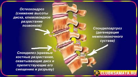 Проблемы с шейным отделом позвоночника