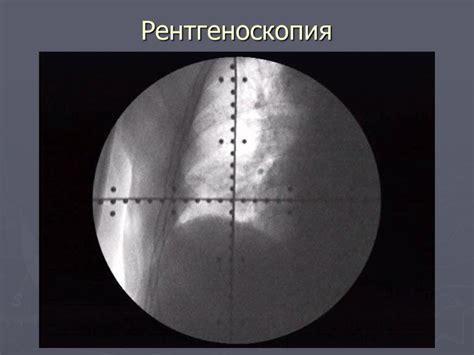 Проведение исследования рентген 2 проекций