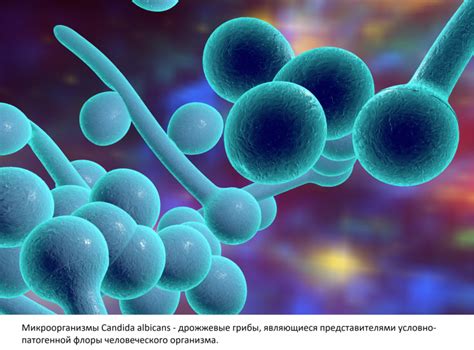 Проведение лечения инфекции Candida albicans