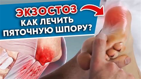 Проверьте ноги и обувь: предотвратите последствия внешних факторов