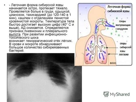 Провоцирующие факторы появления кровянистой мокроты