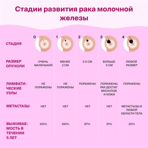 Прогноз четвёртой стадии рака груди