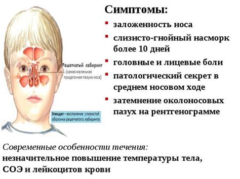 Прозрачная жидкость из одной ноздри: причины и значение