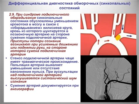 Происхождение обморочных состояний