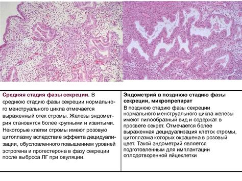 Пролиферация железистого эпителия