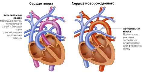 Проследовавшие после межпредсердного сообщения изменения у новорожденного