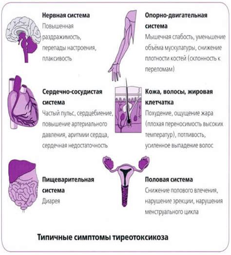 Профилактика Грейвса болезни: как предотвратить ее развитие