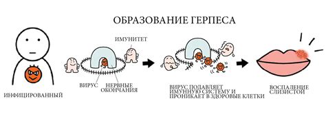 Профилактика герпеса и ее эффективность