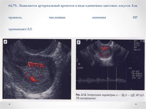 Профилактика гиперплазии эндометрия по узи