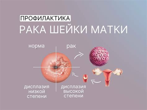 Профилактика гипоплазии шейки матки