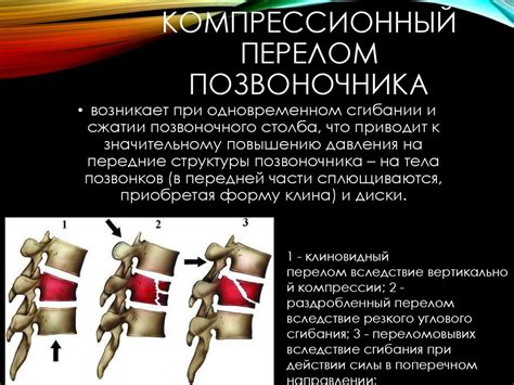 Профилактика компрессионного перелома ноги