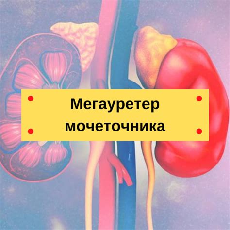 Профилактика мегауретера