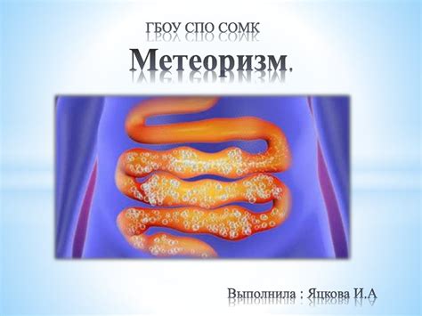 Профилактика метеоризма