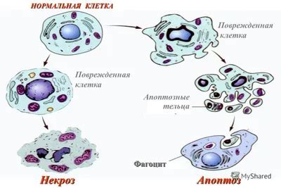 Профилактика некроза тканей