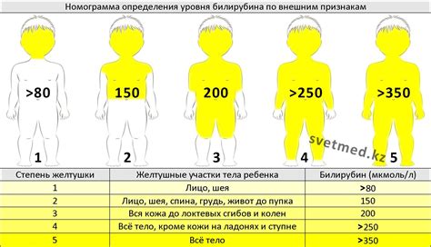 Профилактика неонатальной желтушки у новорожденных