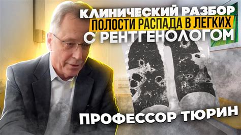 Профилактика полости распада