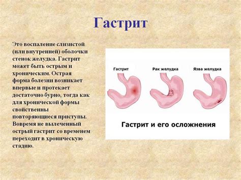 Профилактика развития слепозамкнутой пищеварительной системы