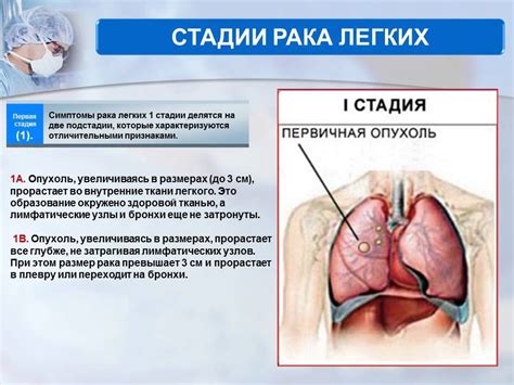 Профилактика стекленения легких 