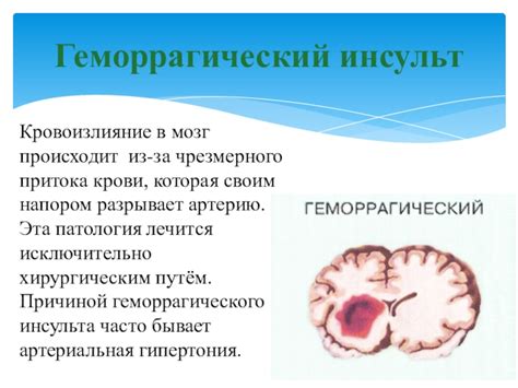 Профилактика увеличения притока крови в правую маточную артерию