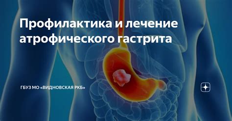 Профилактика эрозивного атрофического гастрита