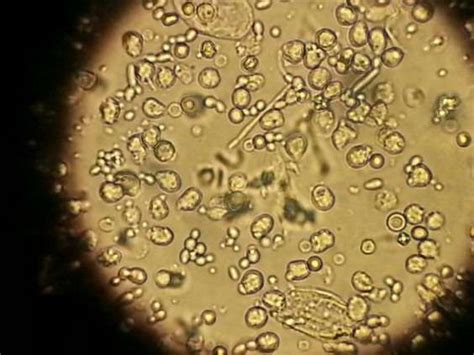 Профилактика Candida Albicans