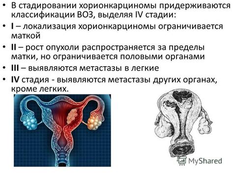 Профилактические меры против образования опухоли за маткой