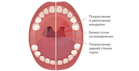 Процесс образования запаха во рту