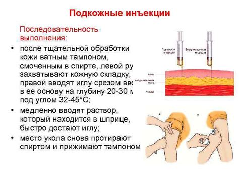 Процесс подкожного введения препаратов: схема и последовательность действий