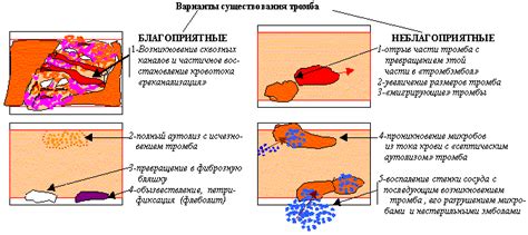 Процесс формирования тромба