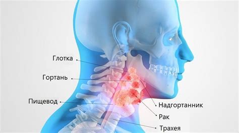 Прочистил горло: причины, симптомы и методы лечения