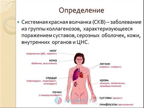 Проявления аутоиммунных заболеваний