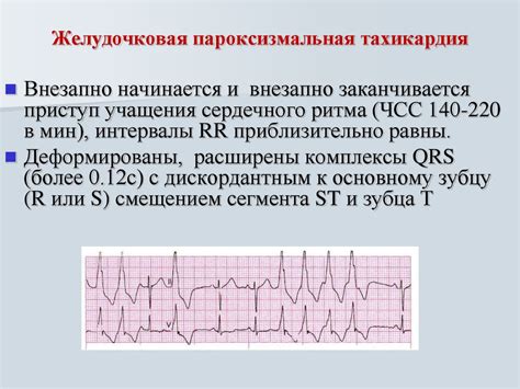 Проявления и симптомы патологической ЭКГ 9150