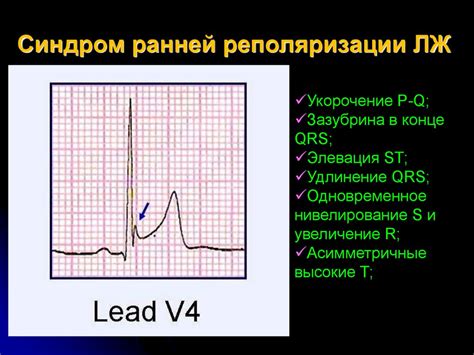 Проявления умеренных нарушений реполяризации нижней стенки сердца