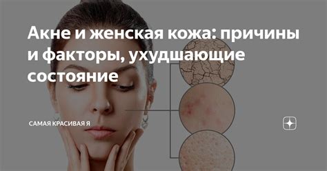 Психологические причины, ухудшающие обаяние